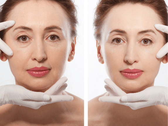 Anti-Aging & Facial Rejuvenation