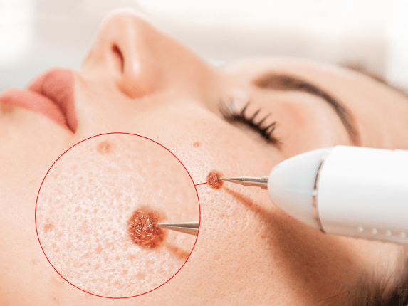 DermatoSurgery Cover